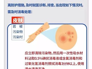 做好居家消毒 预防新型冠状病毒